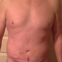 10 day post