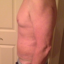 10 day post