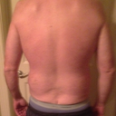 10 day post