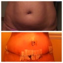 Before/ after 7 day P/O