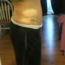 still very swollen and hard from belly button down.