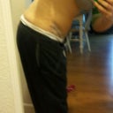 i am anxious for the swelling to go to see my final result in this position.