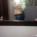 Pre-op