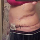 Week 2 - including dent