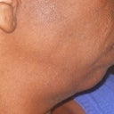 June 20, Before, Side View