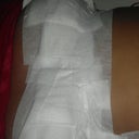 Day after surgery all taped up lol.