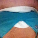 Day of surgery