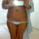 Getting ready for surgery