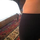 2011 - Best pic I could get of dog ear from behind - 6 months post op - it is actually worse looking than this.  I could not get a good angle with camera
