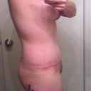 8 weeks- still swollen