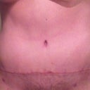 8 weeks