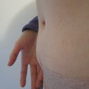 this is the area that's bothering me. I figure the squishiness is to be expected with how thin that skin was but the hard lump underneath is pushing the bulge out further on the one side.