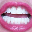 After Invisalign the bottom right teeth were not aligned.