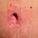 Post Op day 33 - Belly Button!