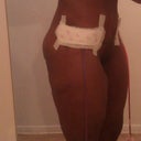 2 days post op