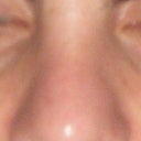 5 weeks after (Front view)
