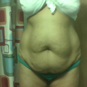 august 2012 wish I wouldve lost more weight before surgery only went down to 160lbs