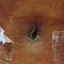 Sooo gross !! That's the scan in my belly button. The stitches are dissolvable...