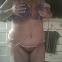 11 days post op