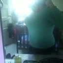 13 days post op side pic