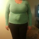 13 days post op front view with 2 drains
