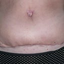 Day 40 - 5 and half wks