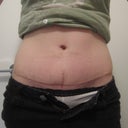 swelling!