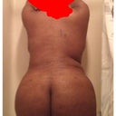 2 weeks post op. this was the first time I let hubby see me naked after the surgery.