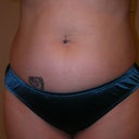 Day before surgery