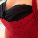 After Breast Augmentation