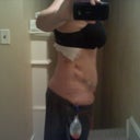 5 days post op right side