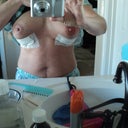 this was day 1, post op. few hours after surgery.