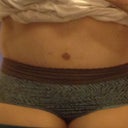 10 days after revision