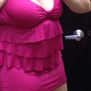 6 months after tummy tuck