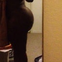 side view salama 3 weeks post op