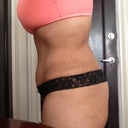 Side view opposite side 7 weeks