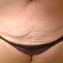 Before. Up close. ugh.