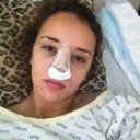 Right after surgery. My eyes bruised and swelled up a lot the day after.