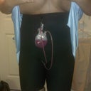 front side swollen