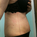 3 wks side