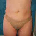 6 Weeks front