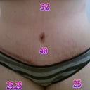 6 weeks post op