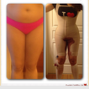 2 day post op waist before 36 1/2 after 29inc holy moly!!! I got my college waist back :D