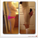 2 day post op check out projection