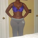 11 weeks post op