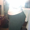 6 days post-op w/o Garment
