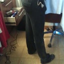 6 days post-op w/o garment