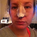 Day 2 post op