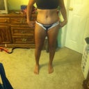 11 days post op scar, not too bad but i know its going to get worse before it gets better