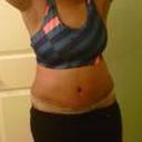 PO Day 5, still swollen but I am liking what I see!